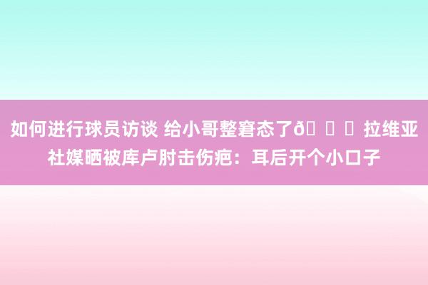 如何进行球员访谈 给小哥整窘态了😅拉维亚社媒晒被库卢肘击伤疤：耳后开个小口子